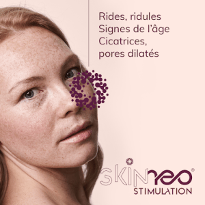 skinneo stimulation microneedling nano boté clermont ferrand