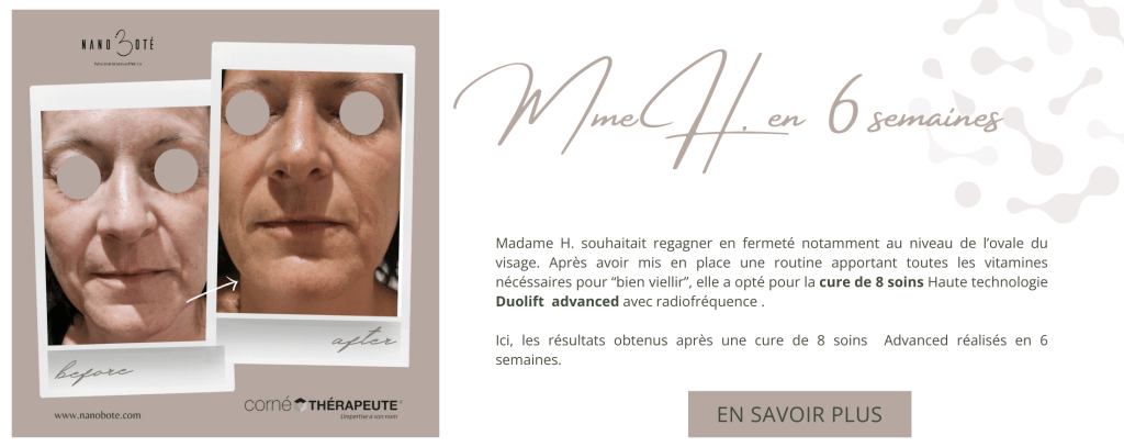 anti âge, rides, lifting soins visage nano boté clermont ferrand