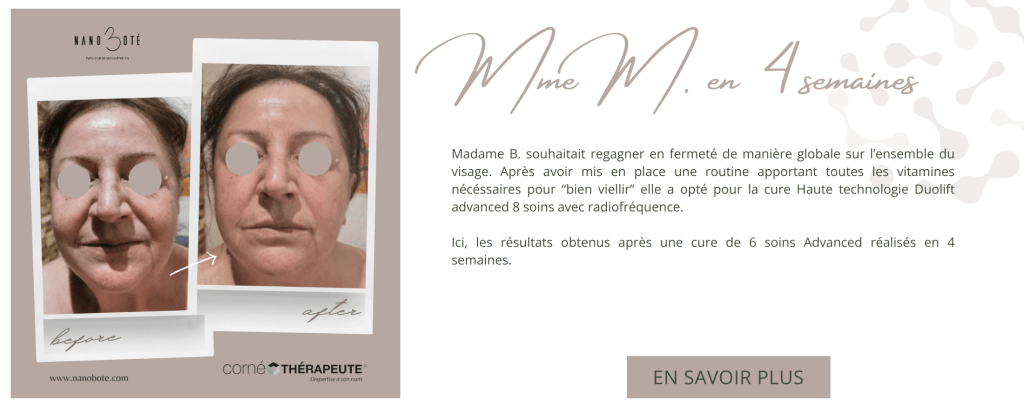 anti âge, rides, lifting soins visage nano boté clermont ferrand 2
