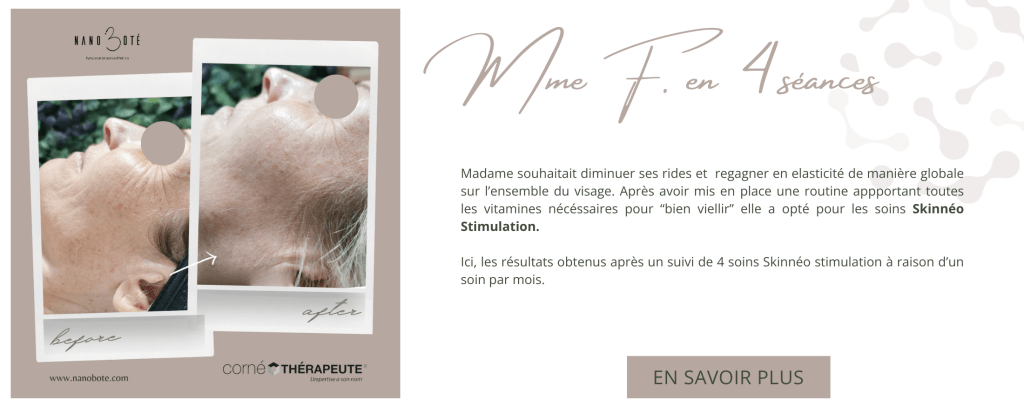 anti âge, rides, lifting soins visage nano boté clermont ferrand 4