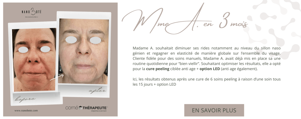 anti âge, rides, lifting soins visage nano boté clermont ferrand 5