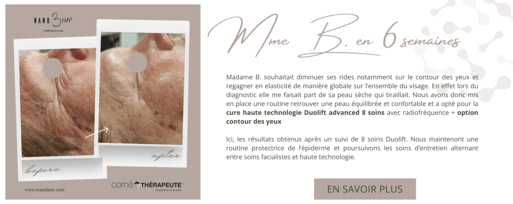 anti âge, rides, lifting soins visage nano boté clermont ferrand 6