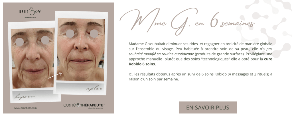anti âge, rides, lifting soins visage nano boté clermont ferrand 7