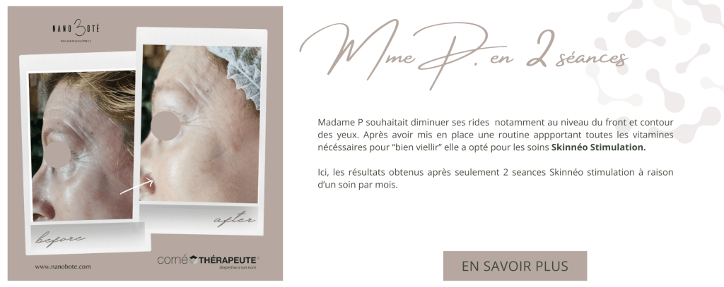 anti âge, rides, lifting soins visage nano boté clermont ferrand 8